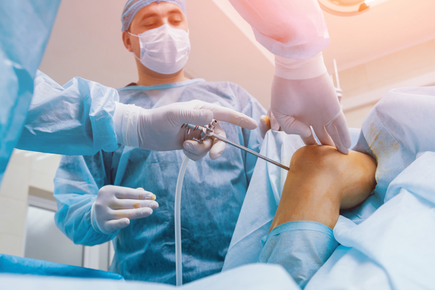 Arthroscopic Surgery