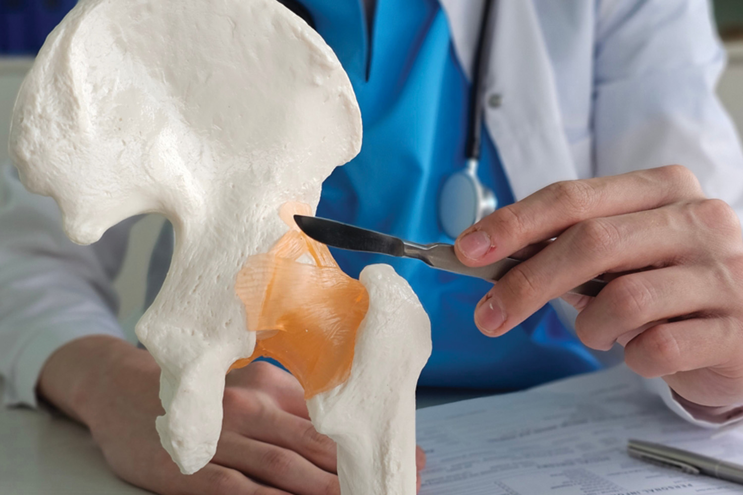 Hip Replacement