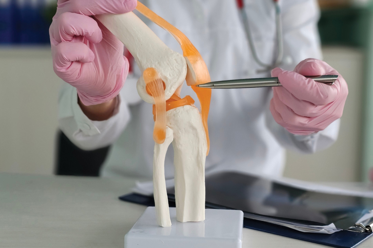 Knee Replacement