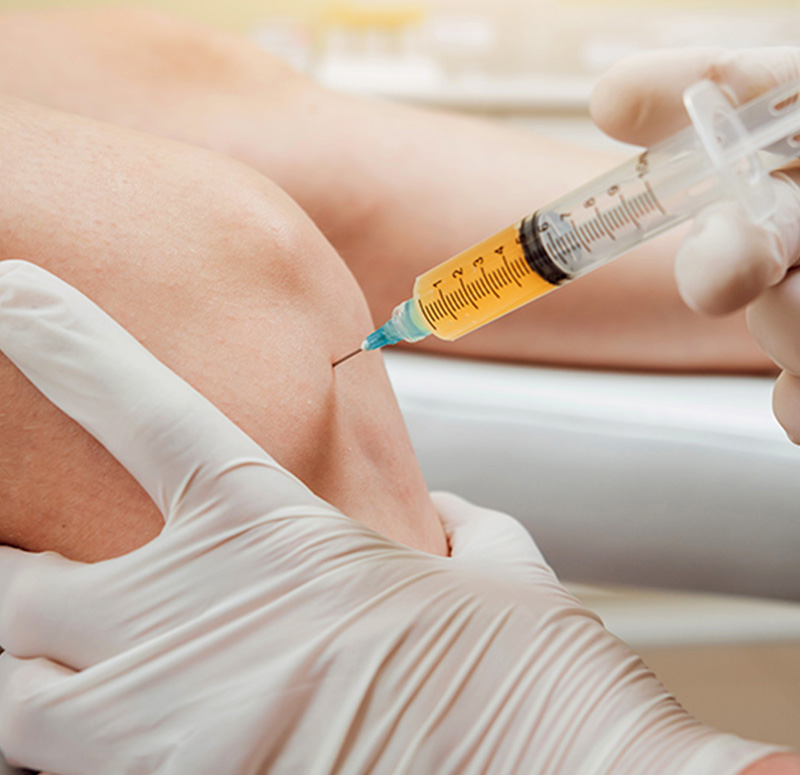 PRP Therapy