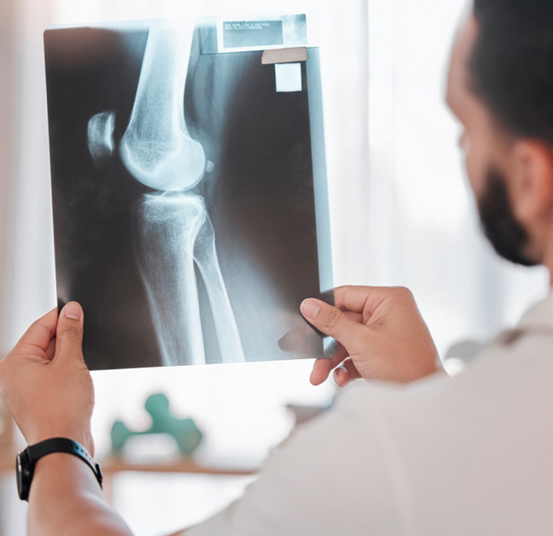 X-Ray